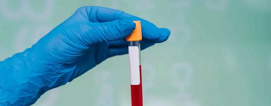 Peut-on être positif avec du CBD à un test de dépistage ?